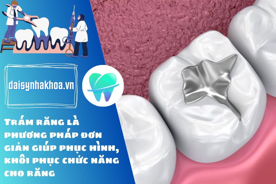 [Quá trình] Trám răng có phải lấy tủy không?